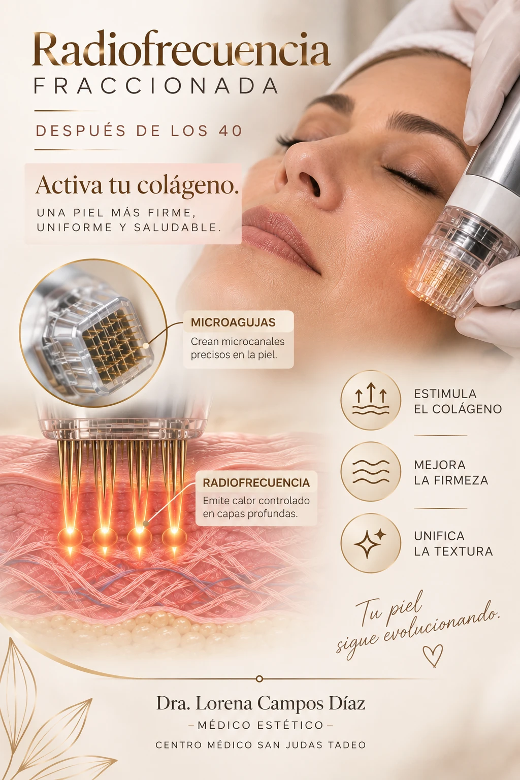 Radiofrecuencia Fraccionada